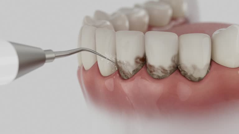 Reliable Emergency Dentist contractor in Vallejo, CA by Smile Center Dentistry